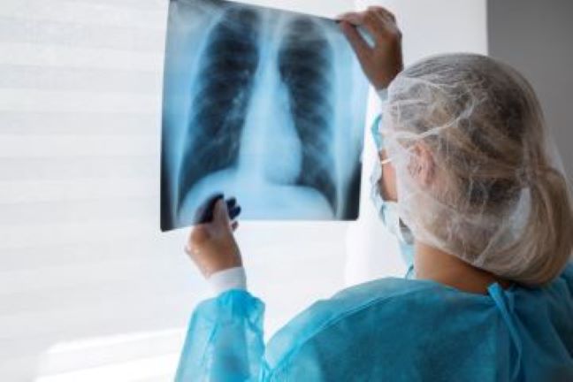 vista lateral medico revisando radiografia